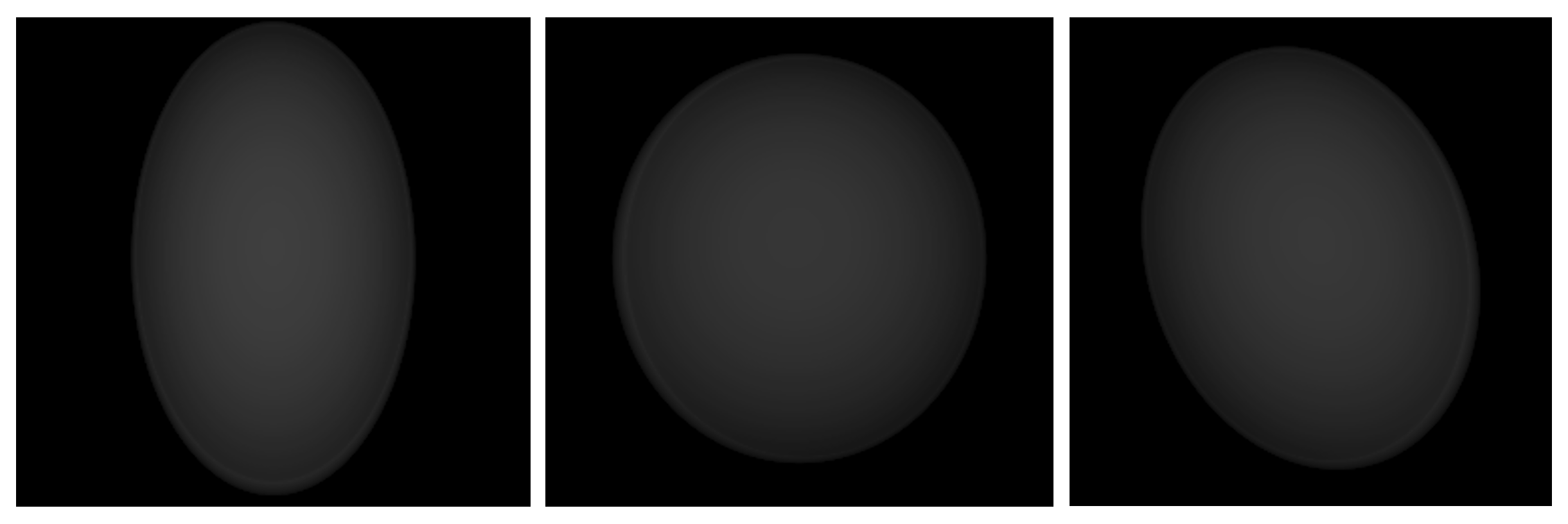 Three model projections of the phantom for planar survey geometry